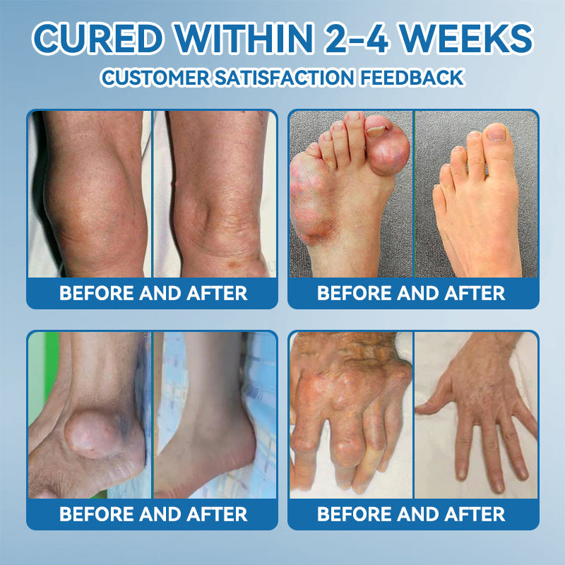 𝖯𝗂𝖼𝗱𝗼® 🦴BPC-157 Joint Healing CreamTreats Arthritis, Neuropathy, Rheumatism, Sports Injuries & More👍
