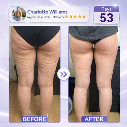 🌿𝐆𝐚𝐟𝐚𝐜𝐞® 𝐂𝐨𝐥𝐥𝐚𝐠𝐞𝐧 & 𝐅𝐮𝐥𝐥𝐞𝐫𝐞𝐧𝐞 𝐑𝐨𝐥𝐥𝐞𝐫 𝐅𝐢𝐫𝐦𝐢𝐧𝐠 𝐂𝐫𝐞𝐚𝐦