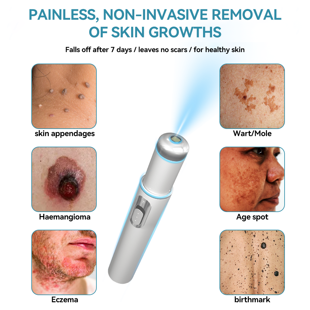 𝐉𝐚𝐬𝐬𝐞𝐞𝐦® Medical-Grade Laser Pen 💕 (Powered by CO₂ laser technology – effectively removes moles, warts, skin tags, pigmentation marks, and other skin imperfections)🏆