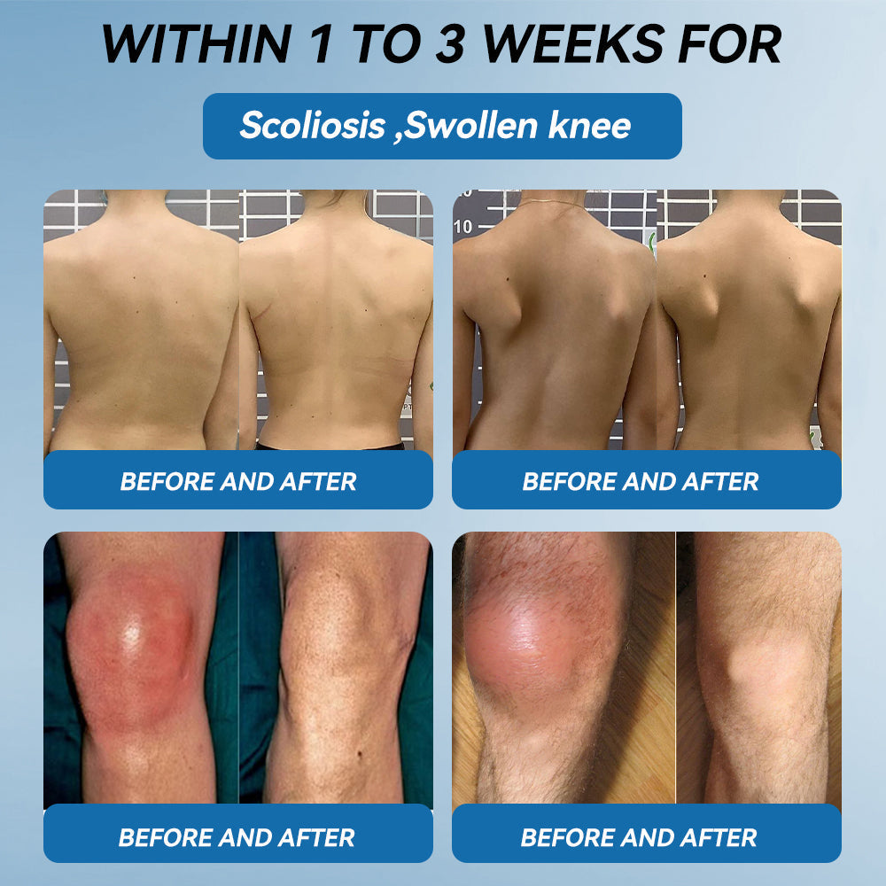 𝖯𝗂𝖼𝗱𝗼® 🦴BPC-157 Joint Healing CreamTreats Arthritis, Neuropathy, Rheumatism, Sports Injuries & More👍