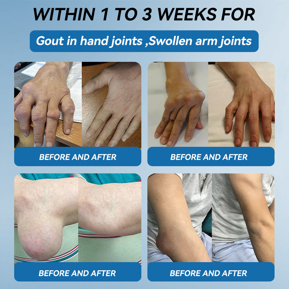𝖯𝗂𝖼𝗱𝗼® 🦴BPC-157 Joint Healing CreamTreats Arthritis, Neuropathy, Rheumatism, Sports Injuries & More👍