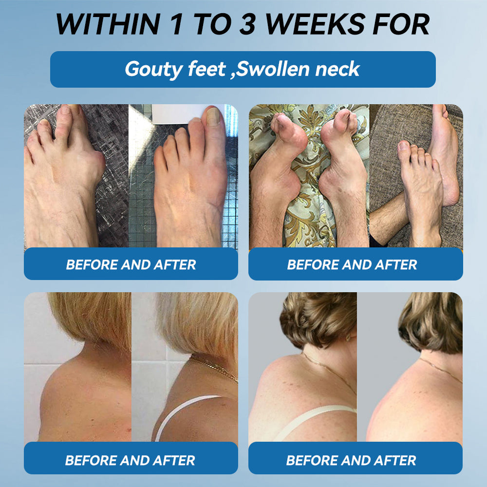 𝖯𝗂𝖼𝗱𝗼® 🦴BPC-157 Joint Healing CreamTreats Arthritis, Neuropathy, Rheumatism, Sports Injuries & More👍