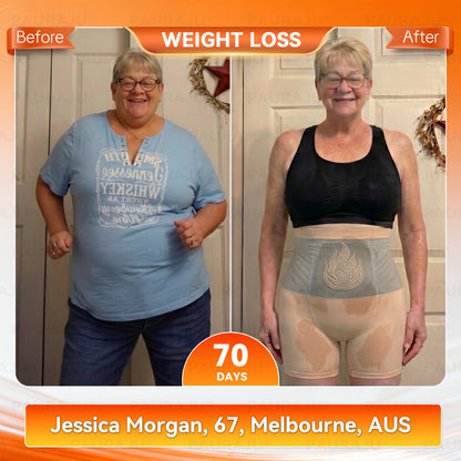 PAURAJU® 30-Min All-in-One Micro-Particle Fat-Burning Shorts🔑Ignites deep microcirculation to melt fat, flush toxins, and reverse metabolic aging.🍟